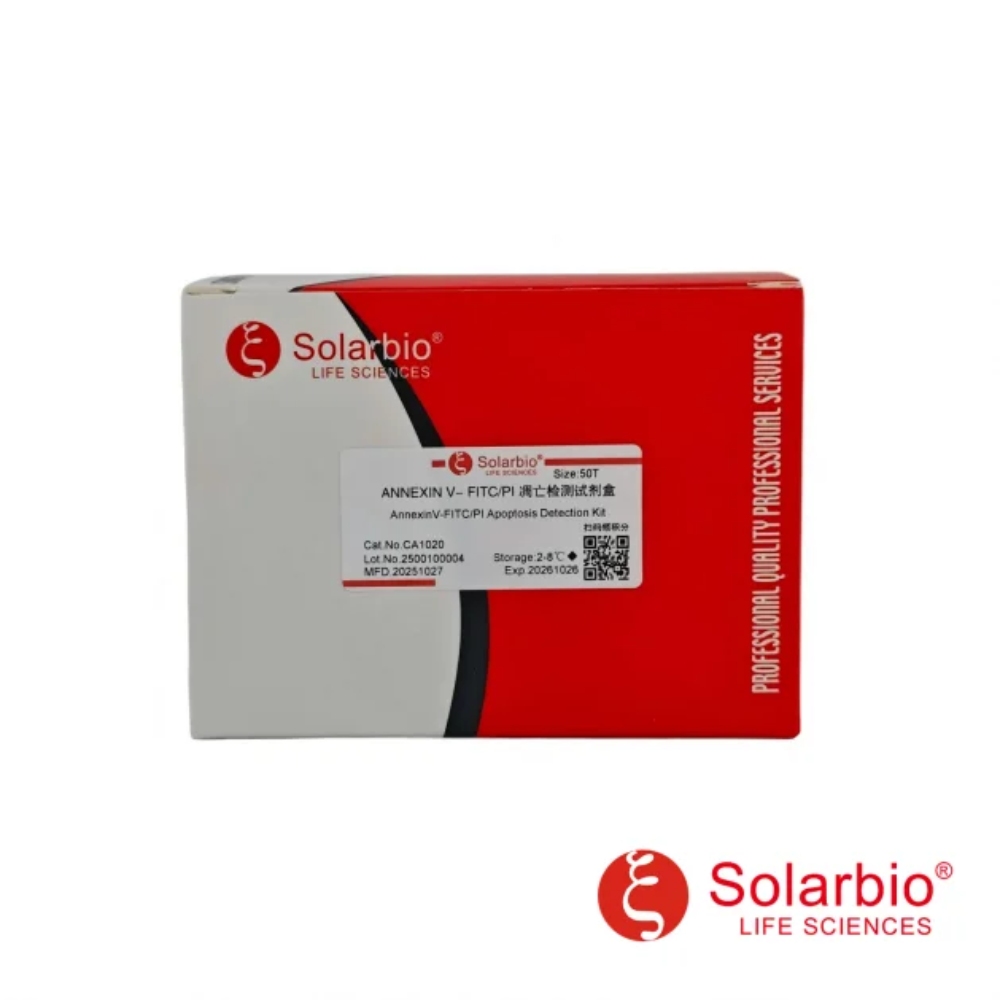 Solarbio Life Sciences reagent kit packaging with clear product labeling and red-white design