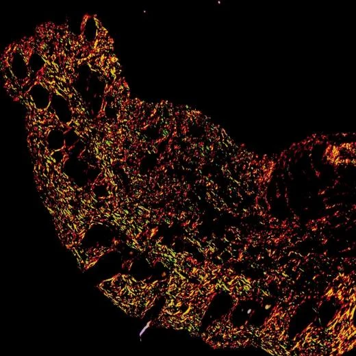 Modified Sirius Red Staining Guide: Principle, Sample Choice, Troubleshooting, and Product Selection Modified Sirius Red Staining Guide: Principle, Sample Choice, Troubleshooting, and Product Selection