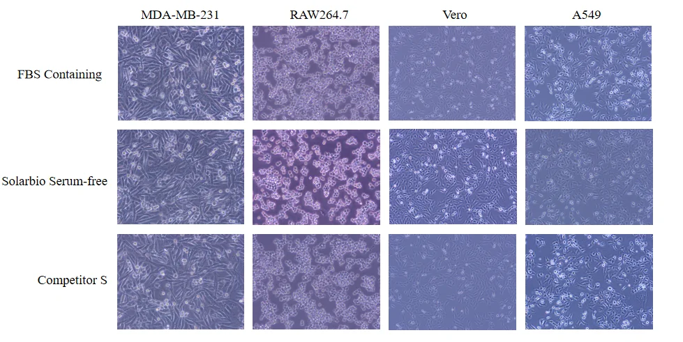 Post-thaw cell morphology comparison across FBS-containing, Solarbio serum-free, and competitor cryopreservation media