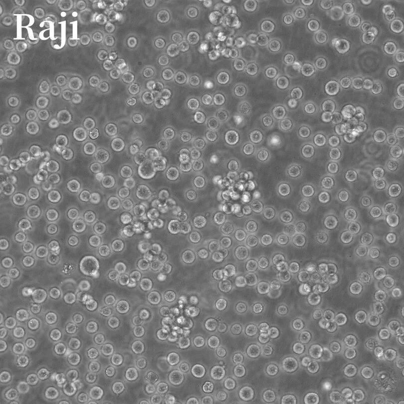 Raji suspension cells show a rounded growth pattern that requires different handling from adherent cells
