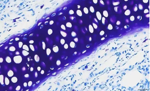 Toluidine Blue O cartilage staining showing reddish purple cartilage matrix and blue background nuclei