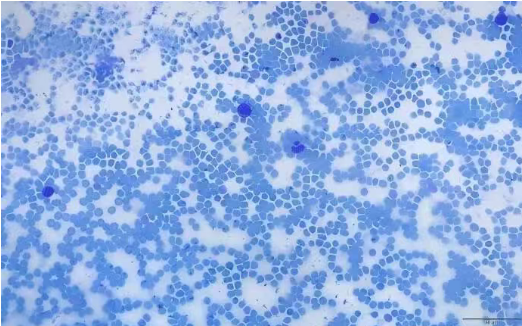 Toluidine Blue O staining of a cell smear showing clear blue and purple-red cellular contrast
