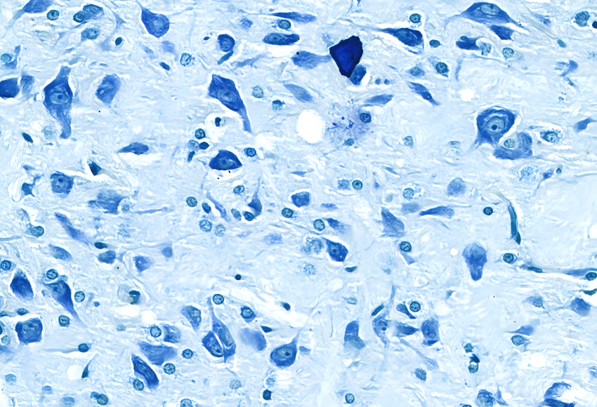 Toluidine Blue O staining showing Nissl bodies and neuronal nuclei in nervous tissue