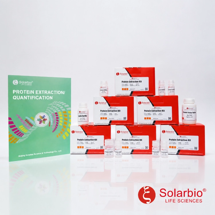 Protein Extraction Kit Guide: How to Choose the Right Solution for Different Research Applications Protein Extraction Kit Guide: How to Choose the Right Solution for Different Research Applications